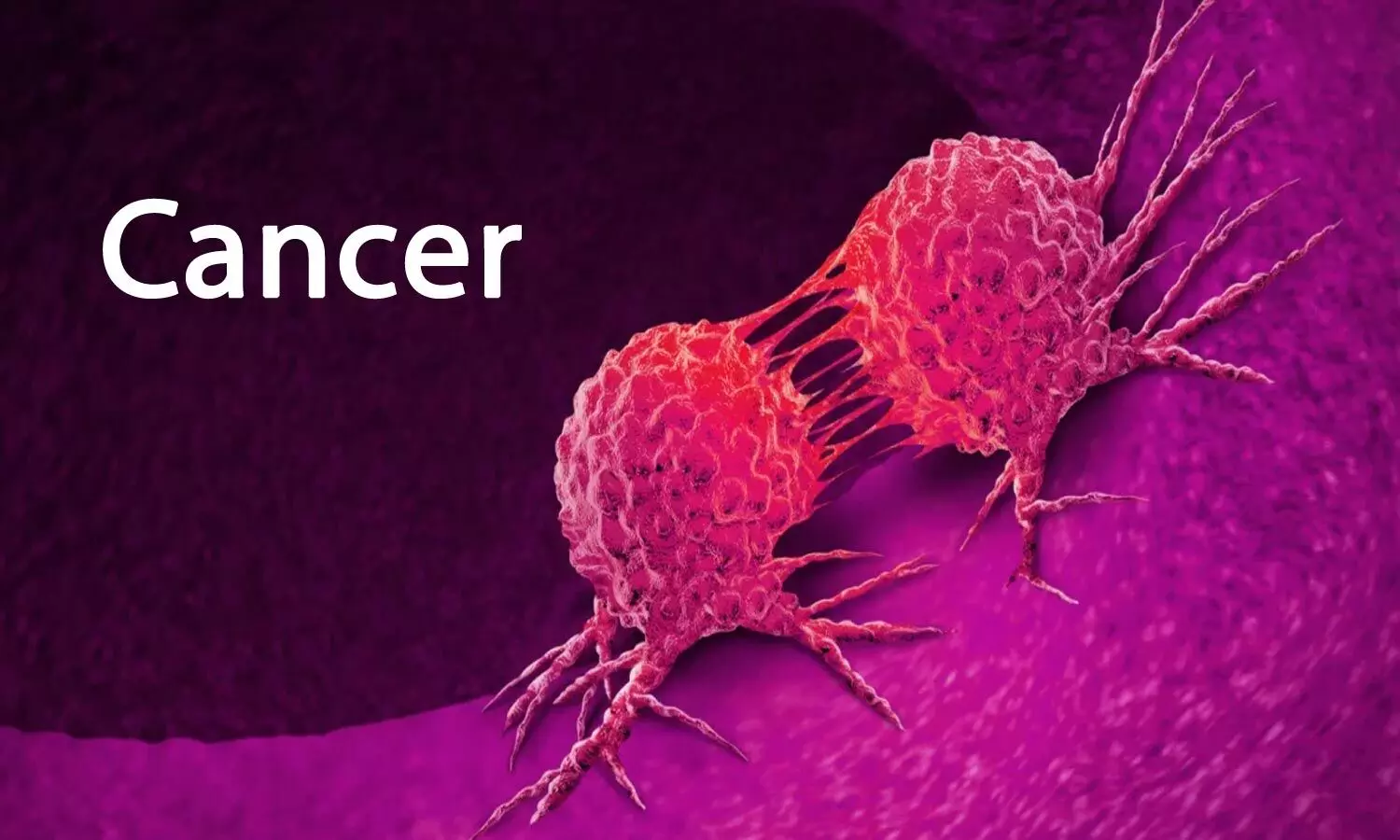 World cancer day 2022: भूलकर ना करें नजरअंदाज, पुरुषों में ये 10 लक्षण हो सकते हैं कैंसर के संकेत
